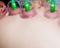 Hijama xidməti